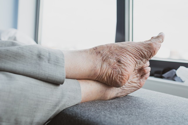 Clive Brown Footcare is pleased to offer home visits to local residents in Cheltenham